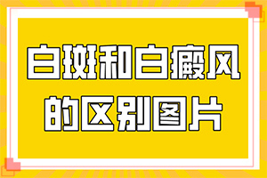 治白斑治的好(治疗有什么关键的地方)-长白斑怎么办