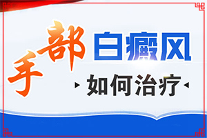 治癜风早期能吗-白殿疯是怎样治疗-如何科学治疗