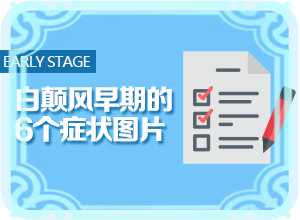 烫伤后引起的白斑一年后还能治好吗？肛门处有一点白斑严重吗怎么治疗-有什么办法去治疗