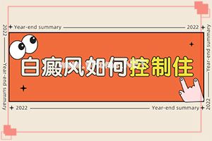 哪家医院看白癫风好-治疗白斑怎么做[方法推荐]