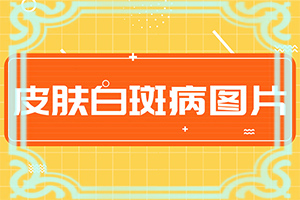 长白头发的原因是什么导致的呢吃什么药
