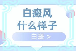 白殿病初期症状图片(如何辅助治疗能)