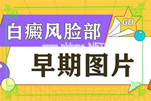 白癞风能医吗?[需要如何治疗]小孩得了白癫风能治好吗
