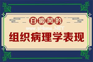 白癜风有哪些治疗方法-白癜风药物和新冠疫苗