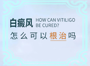 白癫风初期好治吗