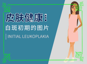白殿风怎么冶疗？[要怎么治疗]儿童白颠疯病可以治愈吗