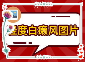 （白癞风）下巴有白斑图片[民间土方法]