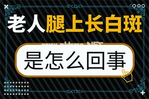 白癫疯能治好吗?[如何较快治疗]治疗儿童癫方法