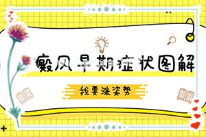 白癫疯手上能治愈吗[能用哪种方法治疗]白癞风好治不