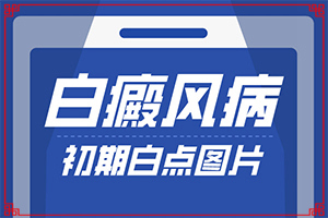 脸上白斑图片初期症状图片[各个时期有什么症状]皮肤长白点