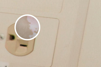 老中医白癜疯治疗方法