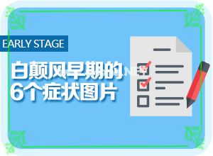白癞风能医吗?[需要如何治疗]小孩得了白癫风能治好吗