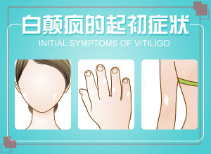 白殿疯初期症状[都有哪些症状]身上有白色斑点