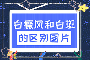 怎么治疗白殿病