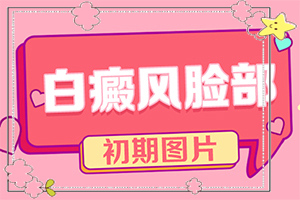 头上有白班是怎么回事,白癜风都有什么症状(主要的症状是什么)