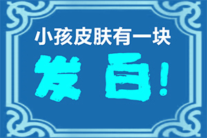 治疗白点病能好吗