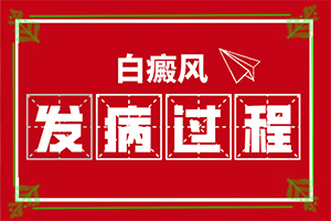 白疯巅有什么症状表现,发生时的特点有(白斑病情有哪些症状)