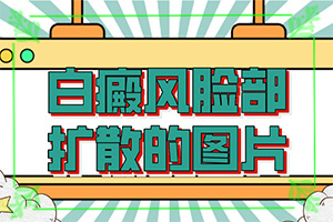 「皮肤上有圆形斑块图片」怎么分辨？发病后会出现哪些表现