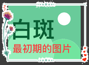 皮肤上出现一块白是什么[哪些症状需要注意]白斑初期症状