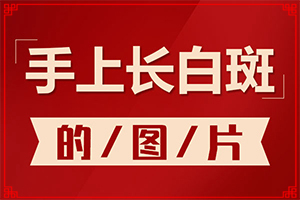 「专业」身体上出了白颠疯按摩那个穴治疗「公开真相」六到七岁的孩子脸上长白斑怎么办