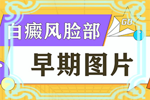「专业看诊」因为缺乏铜而引起的白斑能吗？孩子额头上摔住好啦留了一块白斑怎么办
