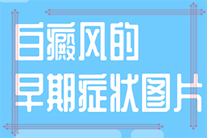 头顶有白发是什么原因呢图片女孩
