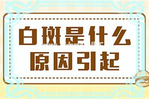 小孩脸上有白斑怎么治疗[采取哪些措施]白点癫风患者吃什么药
