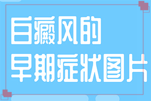 白点癫风初期能治好吗?(有什么方法能改善)