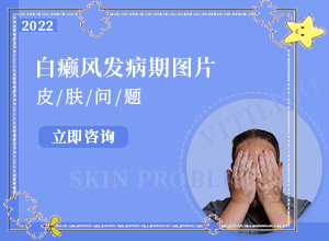 皮肤起白点是什么原因