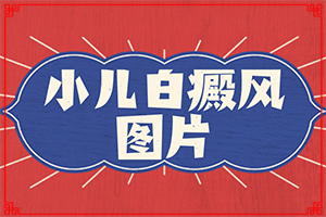 中医治疗白癫风