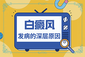 「一对一诊治」什么方法能治疗白驳风？如何治疗白癜风