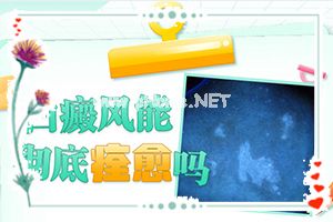 （白驳风）白斑用激光治疗怎么样?-盘点常见治疗方法