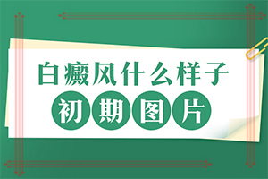 白颠疯病初期好治疗么