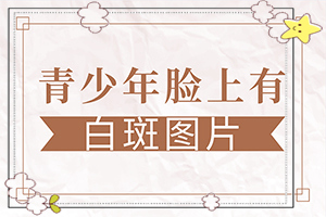 孩子手背上有白斑(发病时病症表现都是什么样子呢)-身上有一块白块