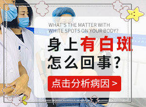 白颠疯眉毛上好治吗