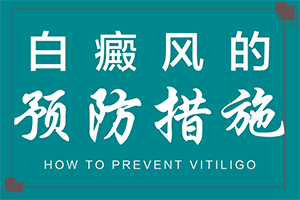 白颠疯多少钱治疗