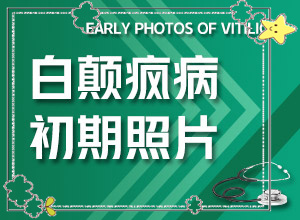 「2022皮肤科」色素减退出现白斑自愈了又出现了？六岁女童脸上有一块白斑怎么回事