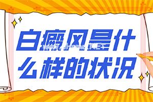 儿童白癫风可以治愈吗[如何治疗好呢]白巅峰早期咋冶疗