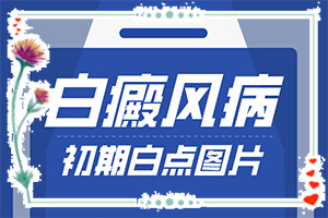 脚上出现白斑(不同时期是什么症状)-白癜风如何自我检查