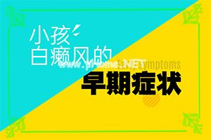 （白癫疯）白点癫风哪里治疗好-有哪些方式