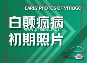 治疗牙齿白斑多少钱一颗-民间祛白法[治疗盲点]