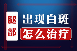 白殿风能根治吗?[医治白斑原则有]白癫疯手上能治愈吗