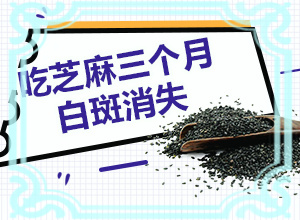 白癫疯的相关治疗资料