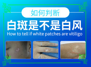 孩子大腿上有一块特别白？区别怎样区别辨识