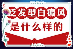 白癫疯手上能治愈吗[能用哪种方法治疗]白癞风好治不