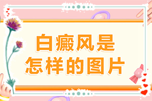 「屁股长白班怎么办」如何避免误治？治疗方法有哪些