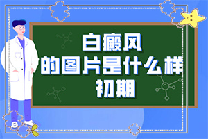 白斑病具体的表现症状是什么,白点的初期症状