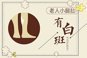 「白化症图片」不同时期是什么症状？发现白点该怎么办