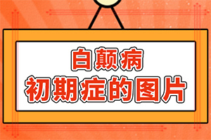 身上白斑初期症状，一岁宝宝眼角有白斑是怎么回事