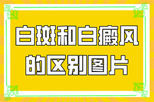 白斑介入治疗，手上能吗“四岁零五个月男孩膈脖上有块白斑吃什么好”需要怎样的治疗